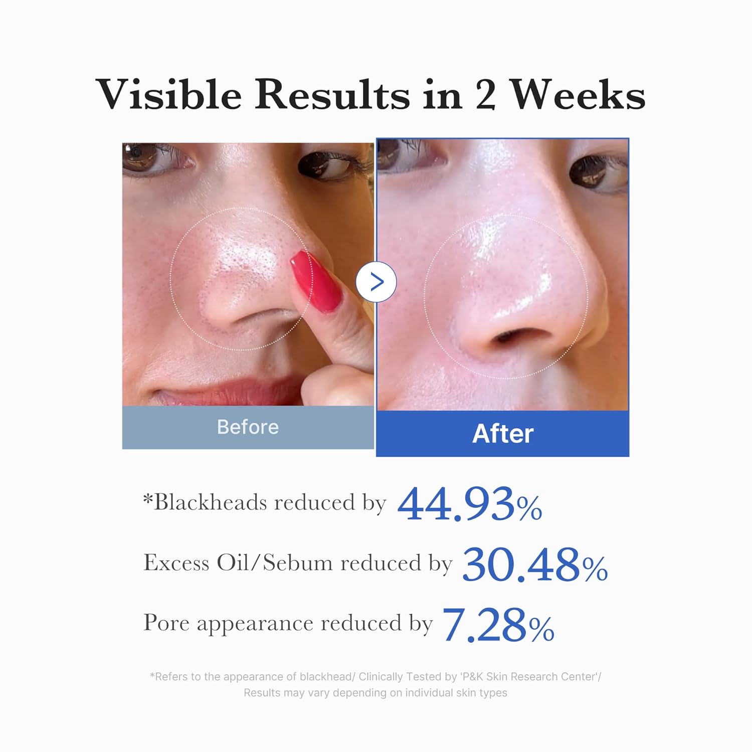 MEDICUBE - Zero Pore Pad (70 Pads) - 155 G Secondary image